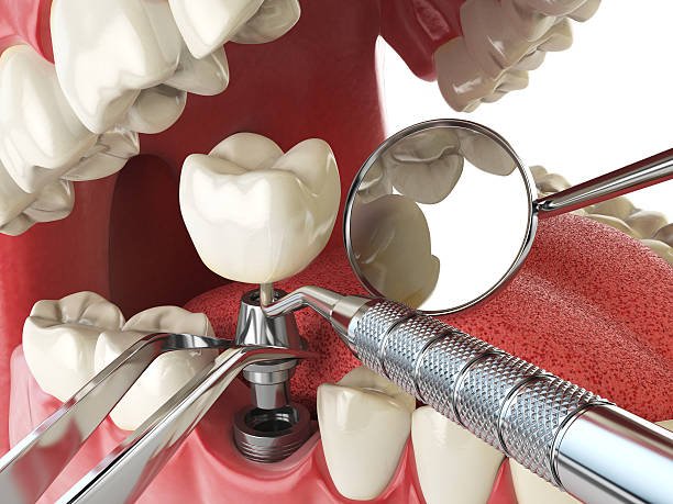 Reliable CA Emergency Dentist Solutions